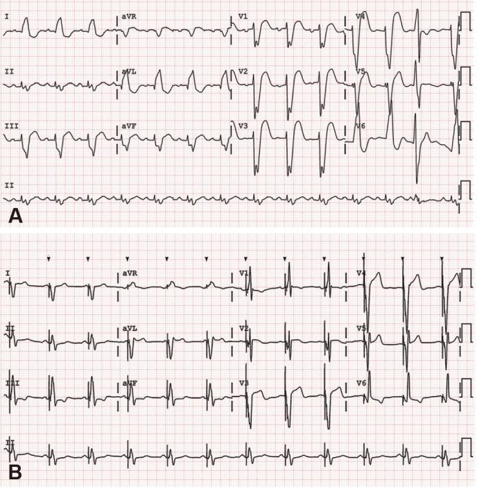 https://cdn.ncbi.nlm.nih.gov/pmc/blobs/a81e/5537155/9aa52210674b/kcj-47-523-g001.jpg