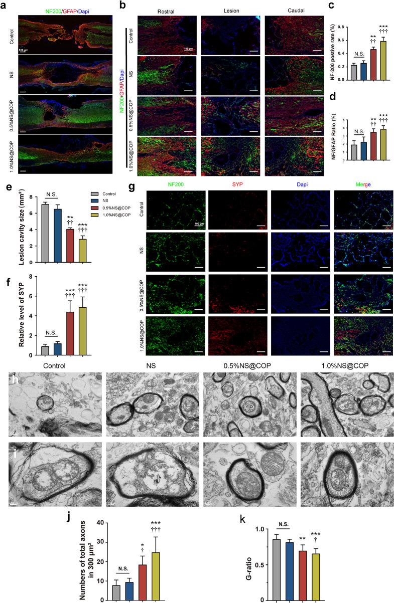 https://cdn.ncbi.nlm.nih.gov/pmc/blobs/a824/11225227/8e3122d09e3a/12951_2024_2594_Fig9_HTML.jpg