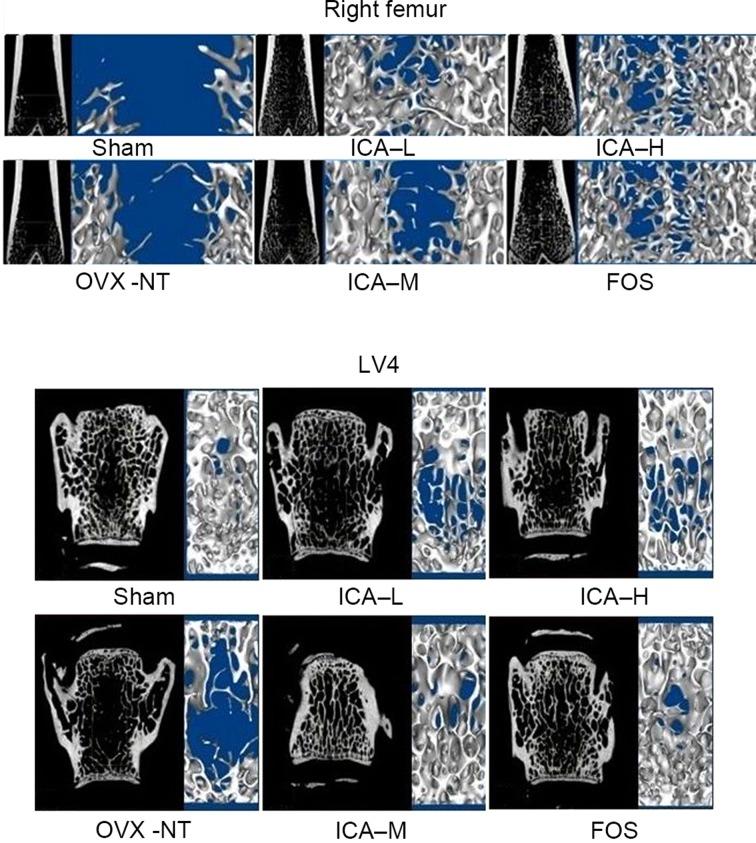 https://cdn.ncbi.nlm.nih.gov/pmc/blobs/a828/5377361/3133b326d815/etm-13-04-1360-g02.jpg