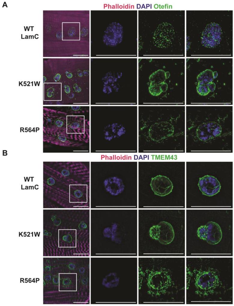 https://cdn.ncbi.nlm.nih.gov/pmc/blobs/a82b/10136830/8b69e80c18c7/cells-12-01142-g003.jpg