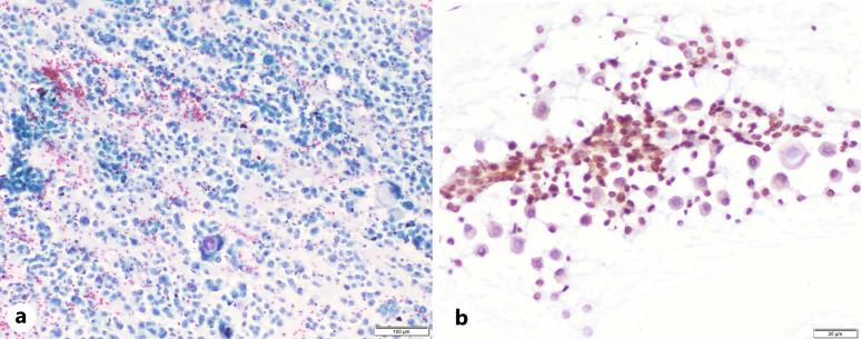 https://cdn.ncbi.nlm.nih.gov/pmc/blobs/a82d/11965865/a90984f5cdbf/acy-2025-0069-0001-541478_F06.jpg