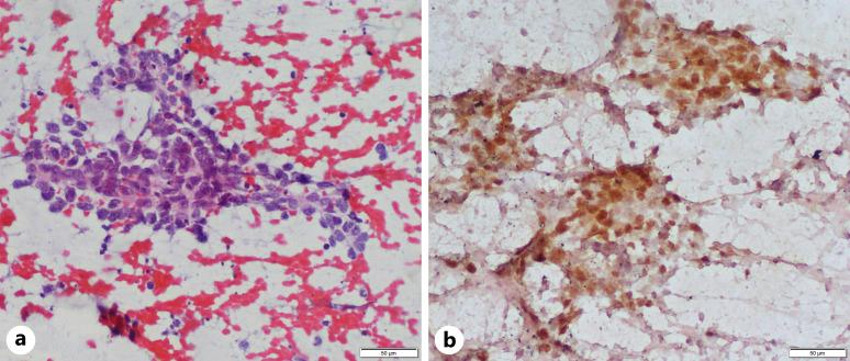 https://cdn.ncbi.nlm.nih.gov/pmc/blobs/a82d/11965865/e78865ba6cf3/acy-2025-0069-0001-541478_F03.jpg