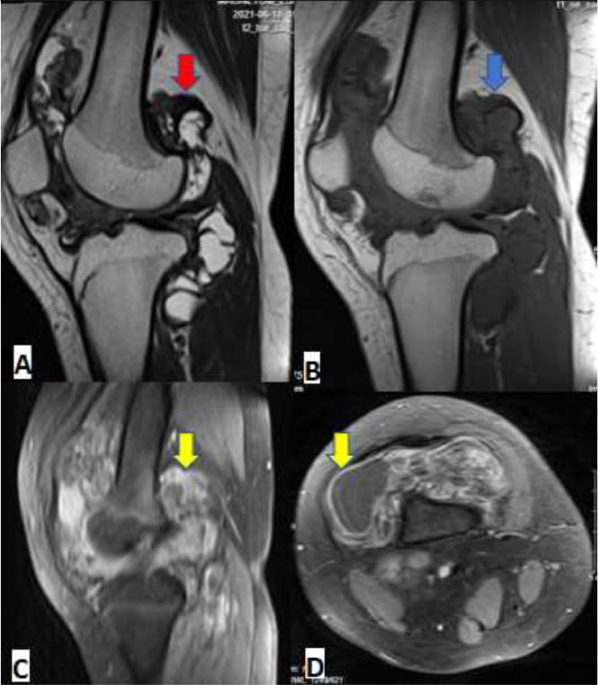 https://cdn.ncbi.nlm.nih.gov/pmc/blobs/a82e/8965772/4df2187c784a/gr3.jpg