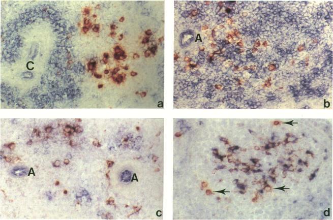 https://cdn.ncbi.nlm.nih.gov/pmc/blobs/a82f/1422104/4d6265a44a61/immunology00088-0039-b.jpg