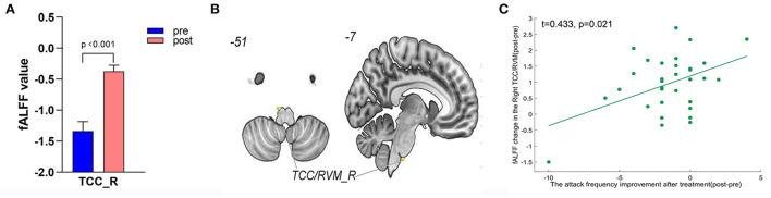 https://cdn.ncbi.nlm.nih.gov/pmc/blobs/a831/9388938/542ed6290f6a/fnins-16-937453-g0006.jpg