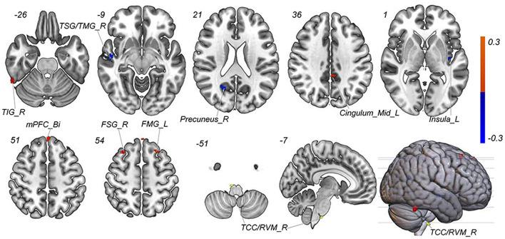 https://cdn.ncbi.nlm.nih.gov/pmc/blobs/a831/9388938/84b97d160e32/fnins-16-937453-g0005.jpg