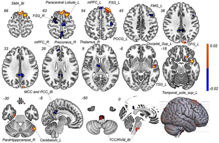 https://cdn.ncbi.nlm.nih.gov/pmc/blobs/a831/9388938/e63019b2330d/fnins-16-937453-g0003.jpg