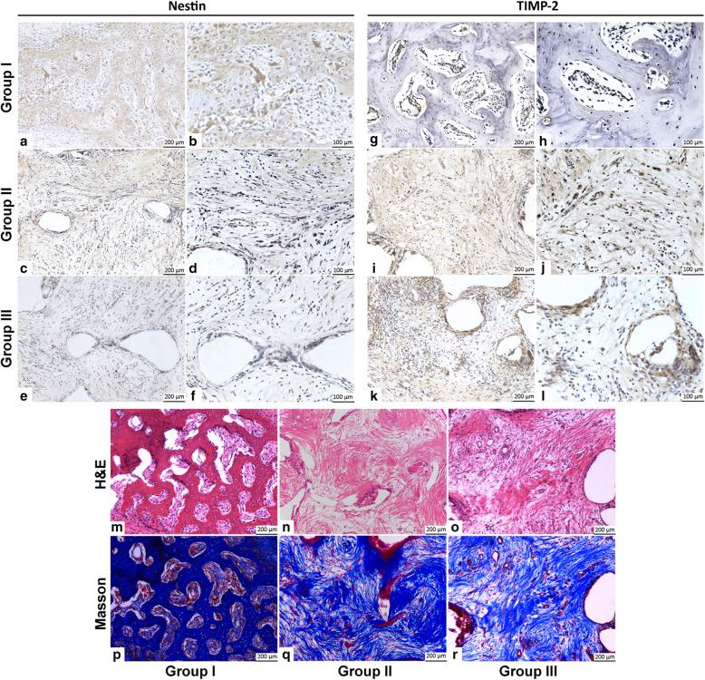 https://cdn.ncbi.nlm.nih.gov/pmc/blobs/a833/8261922/f8a4a1cceda0/13287_2021_2433_Fig6_HTML.jpg