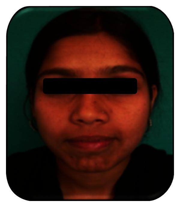 https://cdn.ncbi.nlm.nih.gov/pmc/blobs/a837/3655499/224c3222d587/CRIM.DENTISTRY2013-957418.010.jpg