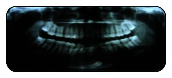 https://cdn.ncbi.nlm.nih.gov/pmc/blobs/a837/3655499/247078555b69/CRIM.DENTISTRY2013-957418.004.jpg