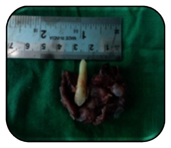 https://cdn.ncbi.nlm.nih.gov/pmc/blobs/a837/3655499/3afbf2bab6dc/CRIM.DENTISTRY2013-957418.009.jpg