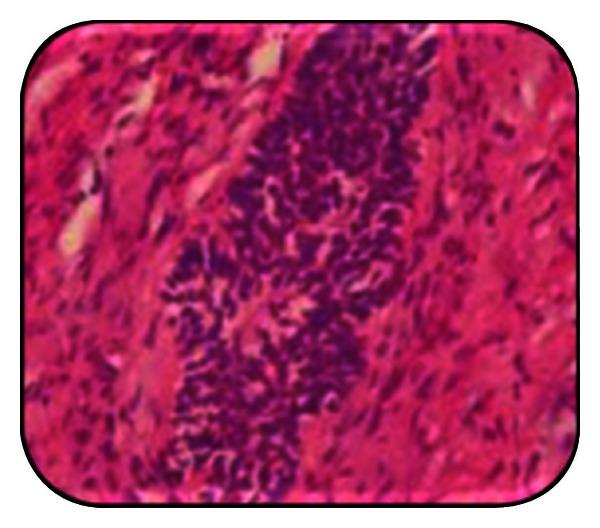 https://cdn.ncbi.nlm.nih.gov/pmc/blobs/a837/3655499/7d889eba2dbd/CRIM.DENTISTRY2013-957418.007.jpg