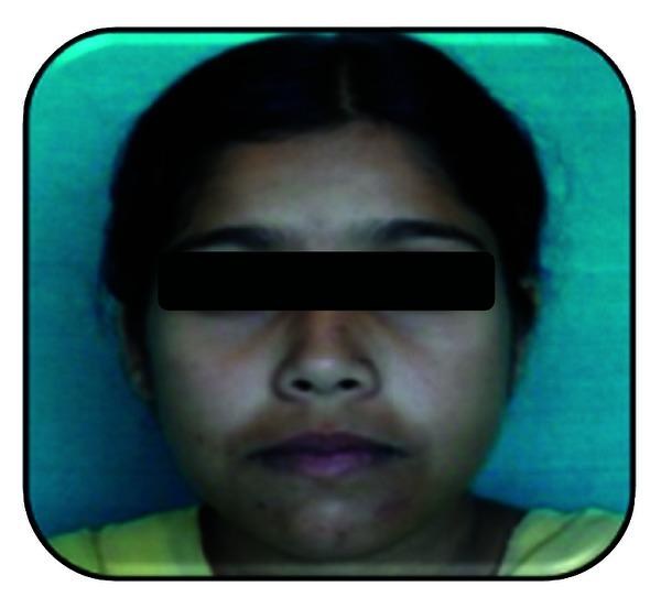 https://cdn.ncbi.nlm.nih.gov/pmc/blobs/a837/3655499/cba0535552de/CRIM.DENTISTRY2013-957418.001.jpg
