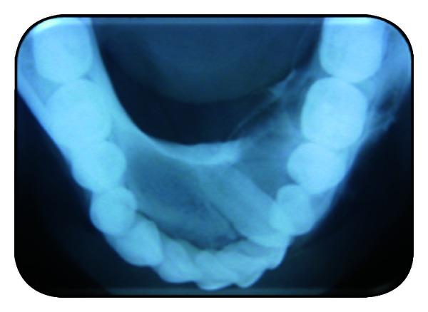 https://cdn.ncbi.nlm.nih.gov/pmc/blobs/a837/3655499/dd9cf581aa22/CRIM.DENTISTRY2013-957418.003.jpg