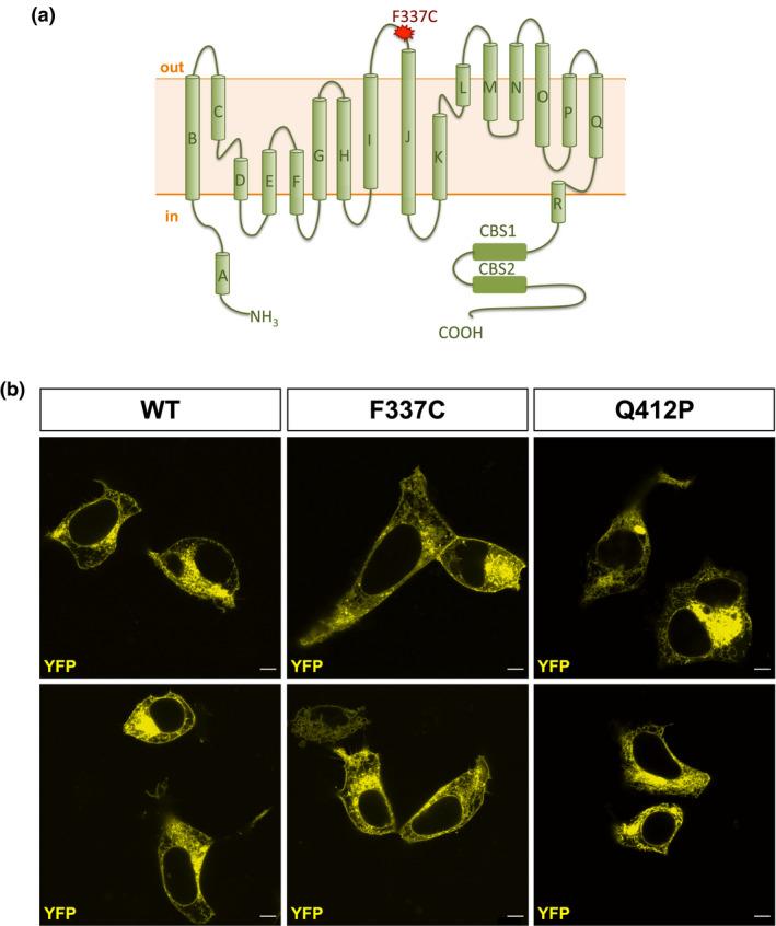 https://cdn.ncbi.nlm.nih.gov/pmc/blobs/a839/8077071/49b77713cae9/MGG3-9-e1588-g002.jpg