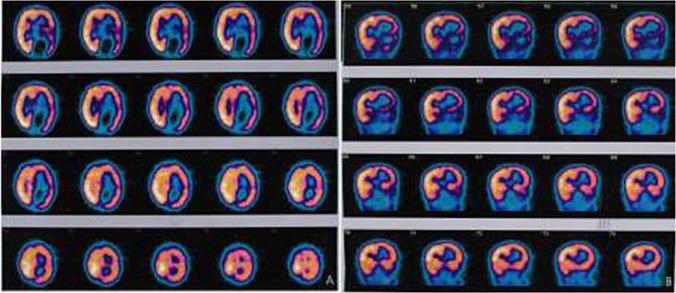 https://cdn.ncbi.nlm.nih.gov/pmc/blobs/a847/4499093/316362986b49/IJPH-43-1702f4.jpg