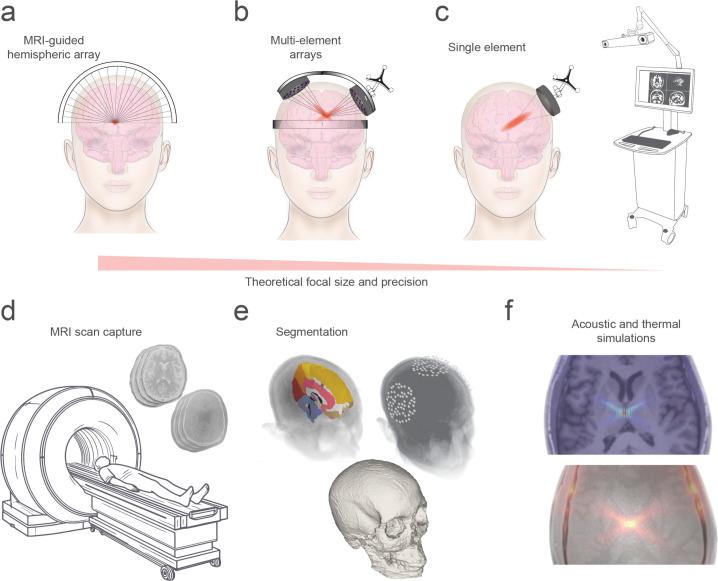 https://cdn.ncbi.nlm.nih.gov/pmc/blobs/a84c/11521279/ec950dbbfc4b/pbio.3002884.g001.jpg