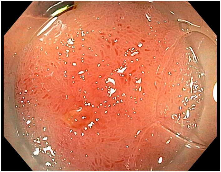 https://cdn.ncbi.nlm.nih.gov/pmc/blobs/a851/10637115/7b3dd27b27a9/UEG2-11-904-g003.jpg