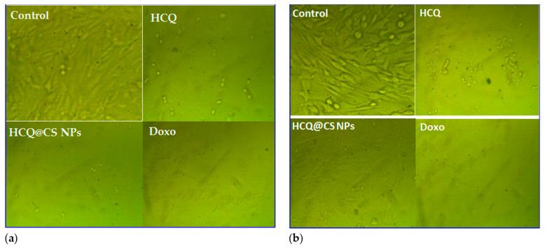 https://cdn.ncbi.nlm.nih.gov/pmc/blobs/a855/10531786/33826225913d/ijms-24-14103-g013.jpg
