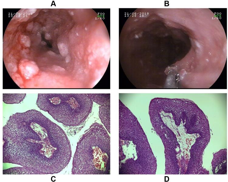 https://cdn.ncbi.nlm.nih.gov/pmc/blobs/a857/7882790/134f489a0ca6/OTT-14-951-g0003.jpg