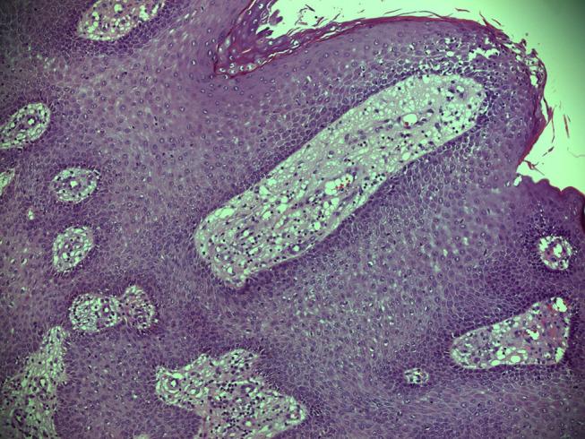https://cdn.ncbi.nlm.nih.gov/pmc/blobs/a857/7882790/9262a4084fa9/OTT-14-951-g0004.jpg