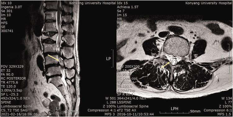https://cdn.ncbi.nlm.nih.gov/pmc/blobs/a860/9909078/514b8ee44f57/10.1177_03000605231153326-fig1.jpg