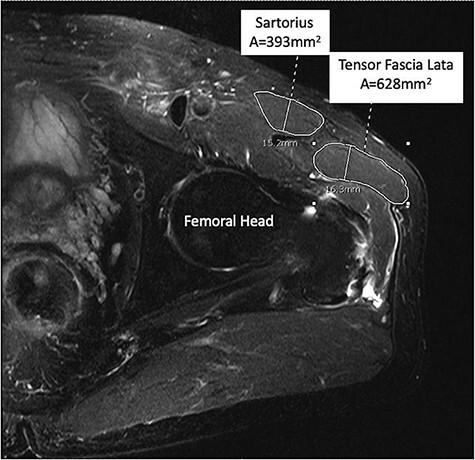 https://cdn.ncbi.nlm.nih.gov/pmc/blobs/a863/8826352/7ca8497383f4/hnab058f1.jpg