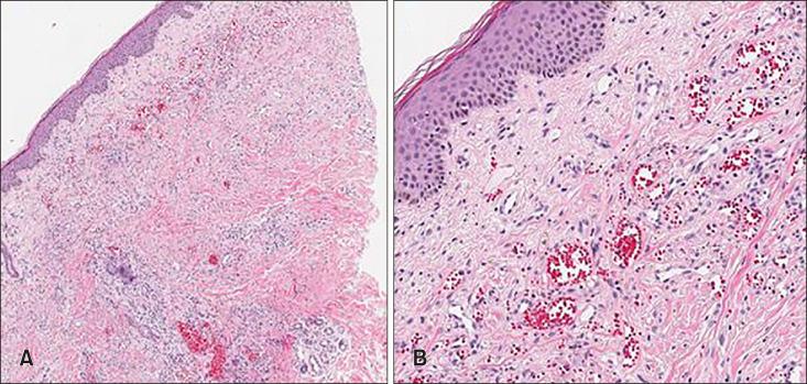 https://cdn.ncbi.nlm.nih.gov/pmc/blobs/a867/8137332/7fe4cb528543/ad-33-278-g002.jpg