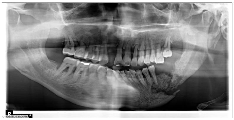 https://cdn.ncbi.nlm.nih.gov/pmc/blobs/a868/10217705/849116fdb8e5/dentistry-11-00136-g008.jpg