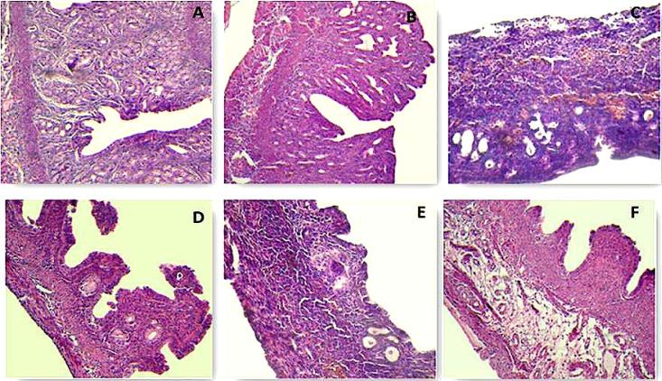 https://cdn.ncbi.nlm.nih.gov/pmc/blobs/a868/4899767/5a16394f189e/ijrb-14-205-g005.jpg