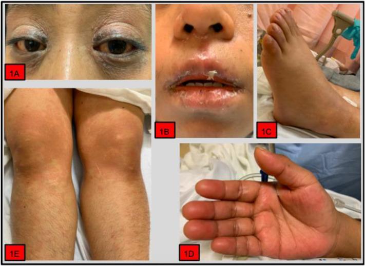 https://cdn.ncbi.nlm.nih.gov/pmc/blobs/a869/7315983/25e74b86b411/gr1_lrg.jpg