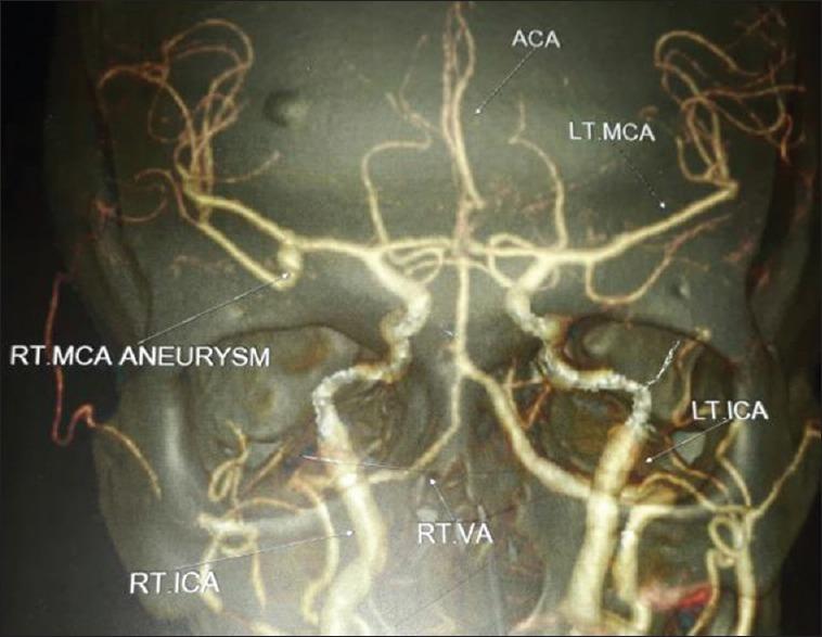 https://cdn.ncbi.nlm.nih.gov/pmc/blobs/a86a/5752802/f8ba2e0b1c9d/IJCCM-21-877-g002.jpg