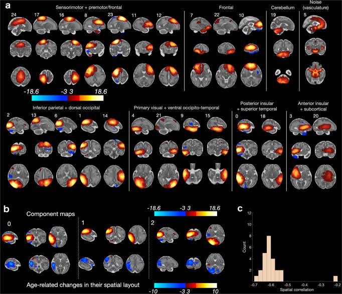 https://cdn.ncbi.nlm.nih.gov/pmc/blobs/a86d/10287667/2fdd9de936bb/42003_2023_4969_Fig4_HTML.jpg