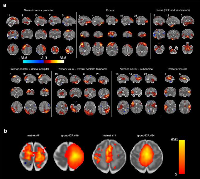 https://cdn.ncbi.nlm.nih.gov/pmc/blobs/a86d/10287667/a0039f345545/42003_2023_4969_Fig5_HTML.jpg