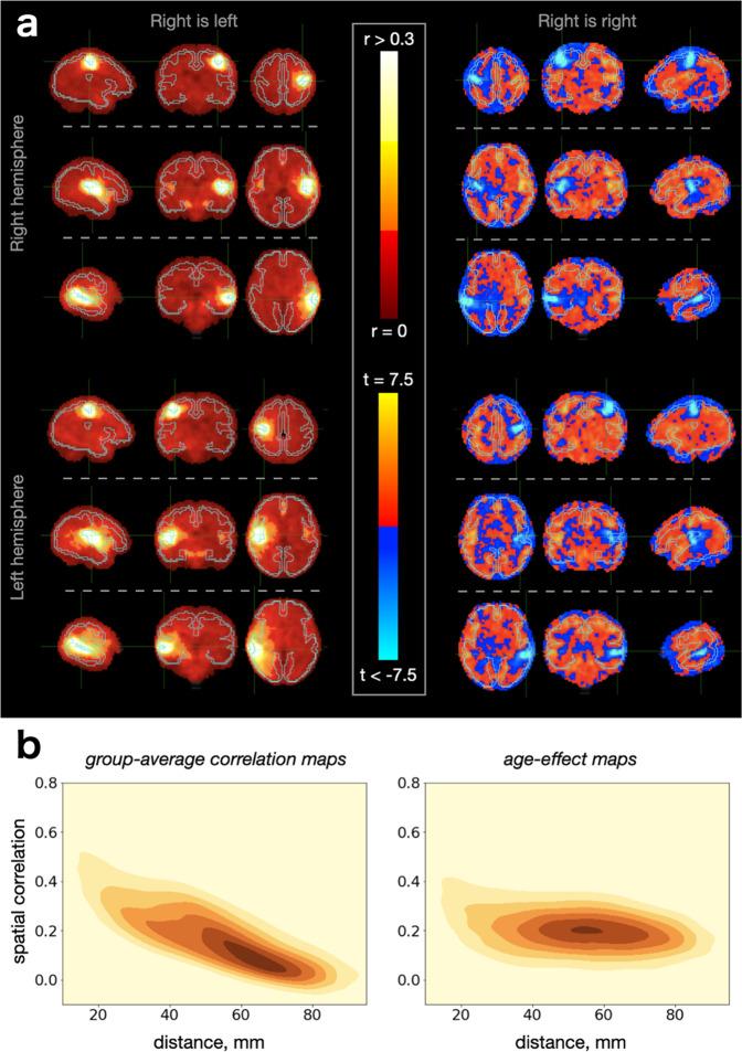 https://cdn.ncbi.nlm.nih.gov/pmc/blobs/a86d/10287667/a1504deb92ce/42003_2023_4969_Fig2_HTML.jpg