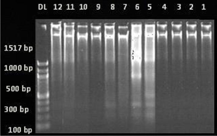 https://cdn.ncbi.nlm.nih.gov/pmc/blobs/a86d/4295053/1db9930dfea0/er-4-2-45f4.jpg