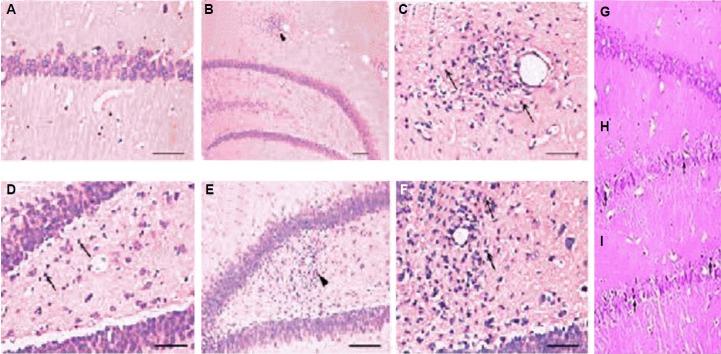 https://cdn.ncbi.nlm.nih.gov/pmc/blobs/a86d/4295053/d0b2d24c813d/er-4-2-45f2.jpg