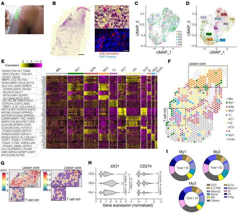 https://cdn.ncbi.nlm.nih.gov/pmc/blobs/a86e/12077899/9842a3485e8c/jci-135-182040-g172.jpg