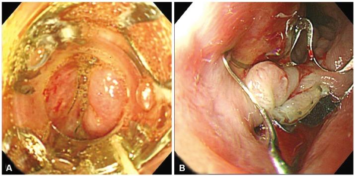 https://cdn.ncbi.nlm.nih.gov/pmc/blobs/a870/4604285/87e4de9b6b08/ce-48-440-g003.jpg