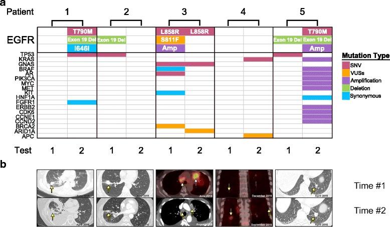 https://cdn.ncbi.nlm.nih.gov/pmc/blobs/a872/5418716/0ace69e312d5/13045_2017_468_Fig6_HTML.jpg