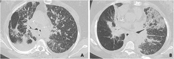 https://cdn.ncbi.nlm.nih.gov/pmc/blobs/a873/9411188/4883bdf092bd/gr3.jpg