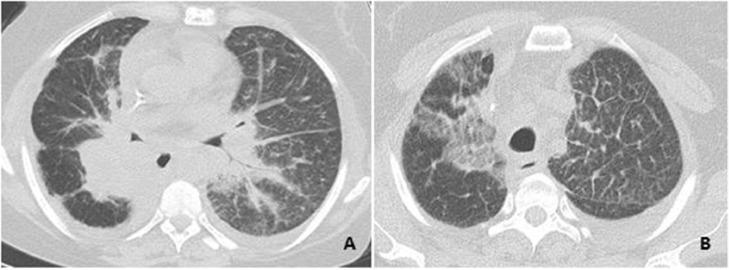 https://cdn.ncbi.nlm.nih.gov/pmc/blobs/a873/9411188/c8132f2483f9/gr2.jpg