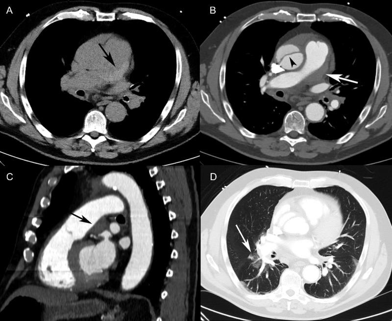 https://cdn.ncbi.nlm.nih.gov/pmc/blobs/a874/8195111/d114b81151ce/jbsr-105-1-2446-g2.jpg