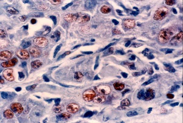 https://cdn.ncbi.nlm.nih.gov/pmc/blobs/a876/2611966/021586d8df02/1746-1596-3-45-9.jpg