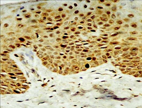 https://cdn.ncbi.nlm.nih.gov/pmc/blobs/a876/2611966/1c2a74f4a44e/1746-1596-3-45-1.jpg