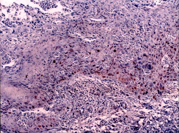https://cdn.ncbi.nlm.nih.gov/pmc/blobs/a876/2611966/7a94422af0c8/1746-1596-3-45-7.jpg