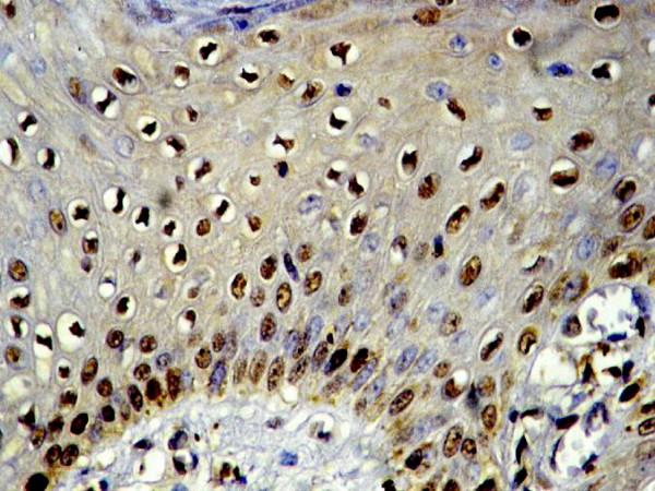 https://cdn.ncbi.nlm.nih.gov/pmc/blobs/a876/2611966/7d73f546dac5/1746-1596-3-45-2.jpg