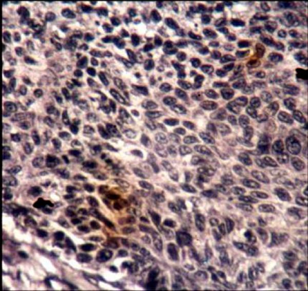 https://cdn.ncbi.nlm.nih.gov/pmc/blobs/a876/2611966/9f254dd1c1b4/1746-1596-3-45-4.jpg