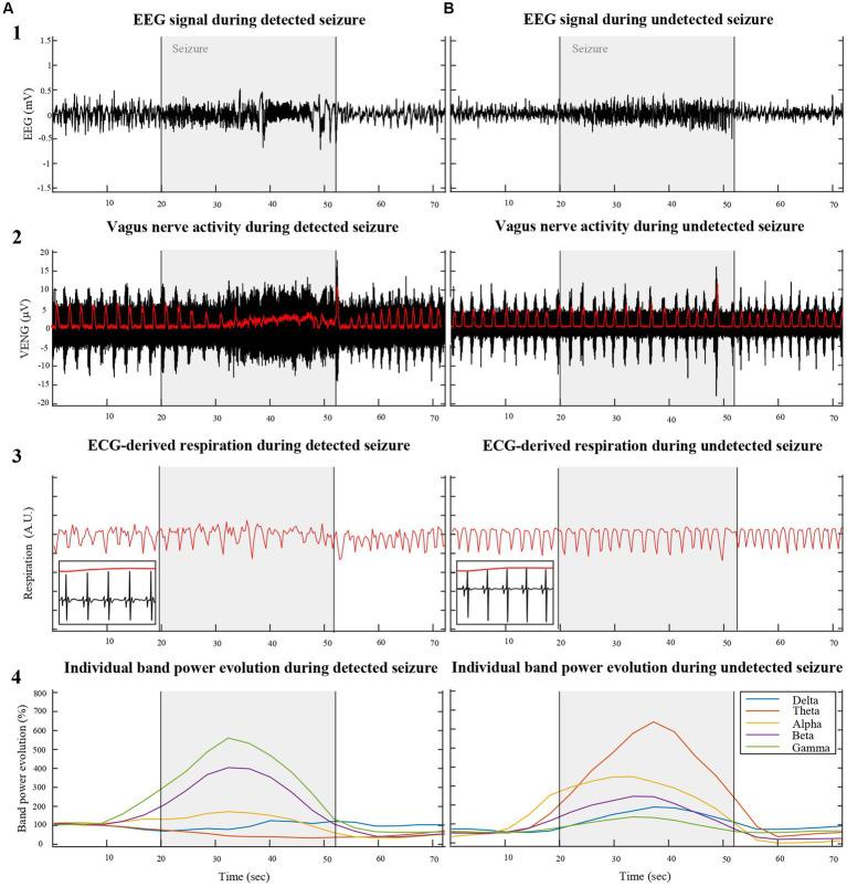 https://cdn.ncbi.nlm.nih.gov/pmc/blobs/a87a/11335647/b069a633763d/fnins-18-1427308-g001.jpg