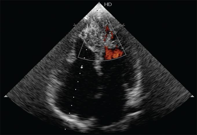 https://cdn.ncbi.nlm.nih.gov/pmc/blobs/a87b/3516015/8444e4293b00/JCDR-3-323-g001.jpg